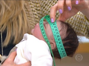  Bebê baiano com zika tinha líquidos no cérebro; caso raro alarma pesquisadores americanos