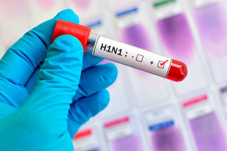  Salvador lidera óbitos por H1N1 na Bahia